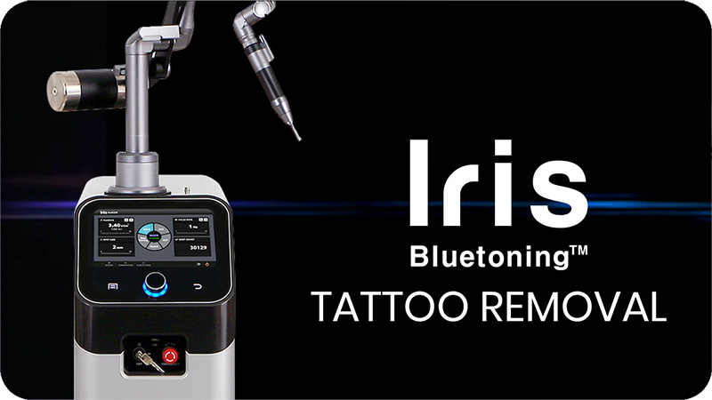  iris bluetoning tattoo removal video thumnnail.png